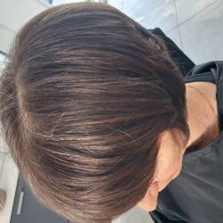 apr�s